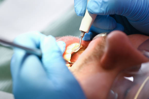 Best Mobile Emergency Dentist in Carbon Cliff, IL