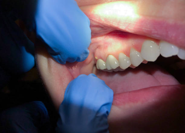Best Broken or Cracked Tooth Emergency Dentist in Carbon Cliff, IL